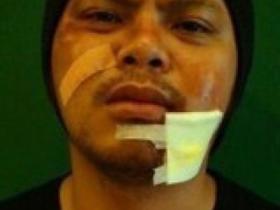 网传辱骂林丹的马来西亚歌手被打